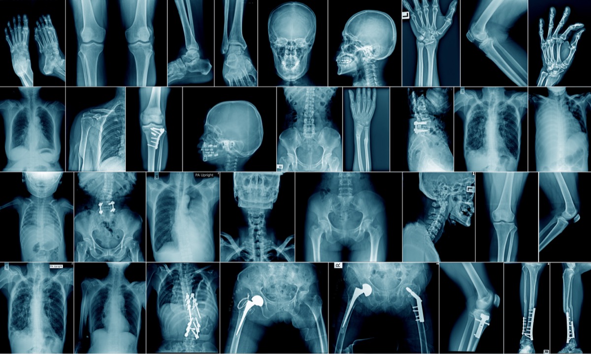 STAT News - AI in Radiology