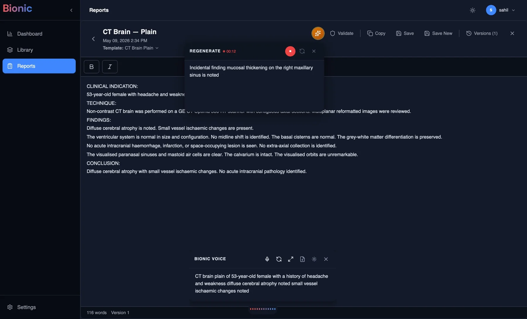Bionic Voice in the Bionic reporting app: a radiologist's dictation for a plain CT brain transcribed at the bottom and turned into a structured report with clinical indication, technique, findings and conclusion